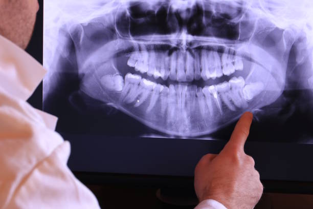 Best Emergency Dental Surgery in Homewood, IL