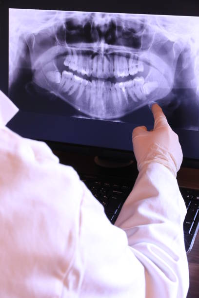 Best Emergency Root Canal Treatment in Homewood, IL