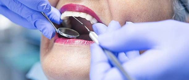 Best Emergency Root Canal Treatment in Homewood, IL